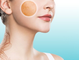 Skin Rejuvenation,Skin Whitening & Resurfacing. Freckles, Black $pots,Age Pigment,Café au LaitSpots & Sunburn Removal. Epidermis & Dermis Pigmentation Removal. Body Tattoo, Eyebrow Tattoo & Lips Line Removal. Nevus of Ota & Birthmark Remowal.