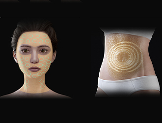 Micro-pulse treatment
Basic treatment efficacy, add new operation scheme, consolidate the effect and expand the scope of application.
Circular MP mode, circular dot mode can be selected, the same probe touch interface can change the mode freely.
Focused ultrasound combined with 6.78MHz radio frequency will penetrate the energy from the epidermis to the fat layer synchronously, burning fat quickly. The output energy effect area reaches 40MM*50MM, which can instantly eliminate fat in a large area on a large scale.