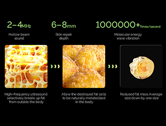The hollow beam sound wave technology is adopted. Countless high-intensity heat energy is beamed and transferred in a dot matrix. High-energy matrix molecular energy waves vibrating up to millions of times per second are emitted through 4MHz and 2MHz. They penetrate deep into the subcutaneous tissue, and all the energy converges to form a beam point. The depth of 6–13mm is repaired, and the skin tissue is strongly impacted, producing an electric field gathering effect on the skin tissue. The channels for the skin to absorb nutrients and excrete toxins are opened, and the barrier between the epidermis and the fat layer is emptied, so that the fat is quickly metabolized and absorbed, promoting metabolism, and achieving the effect of skin firming, slimming and shaping.