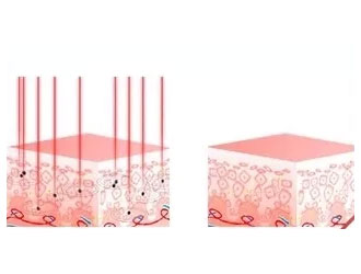 For all exogenous and endogenous pigments, the effect is more significant