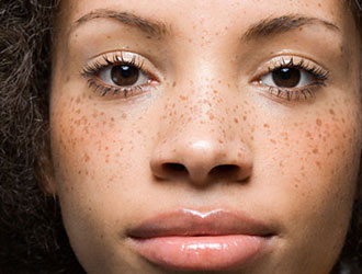 Do not break the hair follicle,or hurt the normal skin,or produce the scar formation