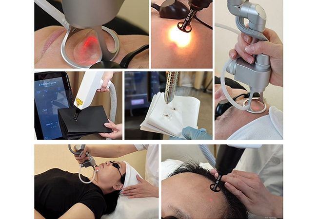 Picosecond Treatment Scope