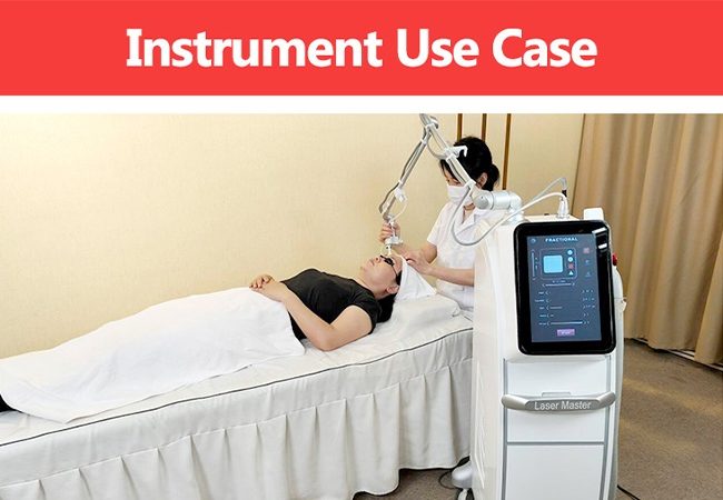 Picosecond Treatment Results